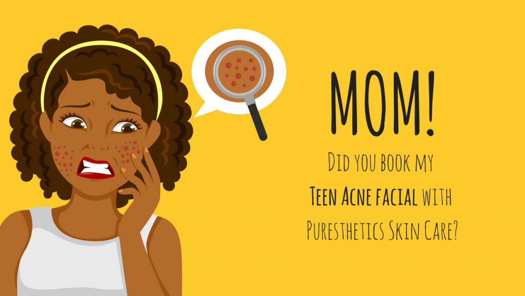 When Does Teenage Acne Go Away? (How Long Does it Last?) When Does Teenage Acne Go Away? (How Long Does it Last?)