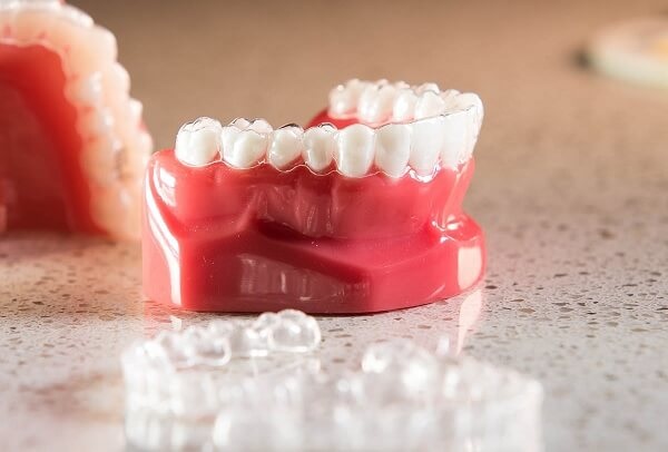 Khay niềng không hề gây đau nhức, khó chịu