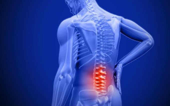 Triệu chứng thoái hóa cột sống thắt lưng