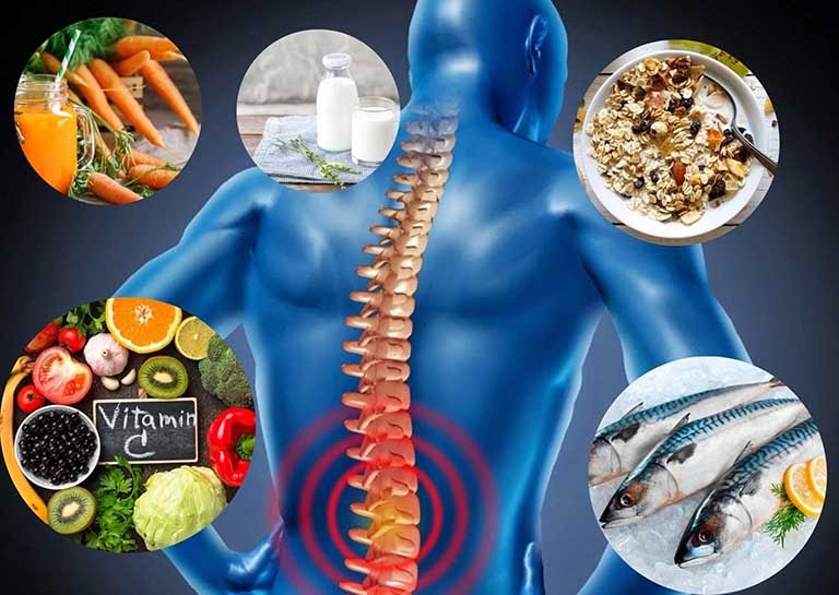 Thoái hóa cột sống do chế độ ăn uống