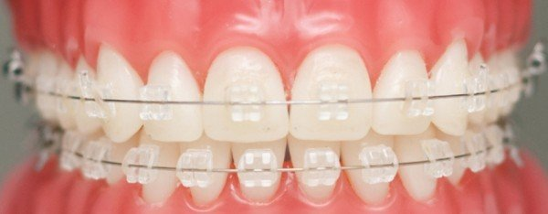 Mang lại hiệu quả thẩm mỹ tuyệt đối 