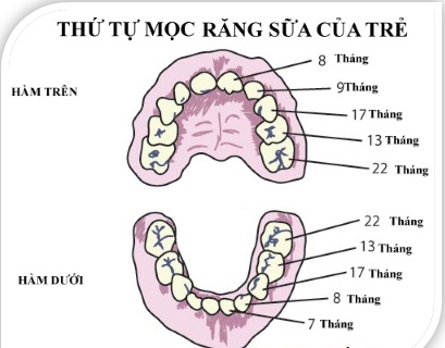 Thứ tự mọc răng sữa của bé