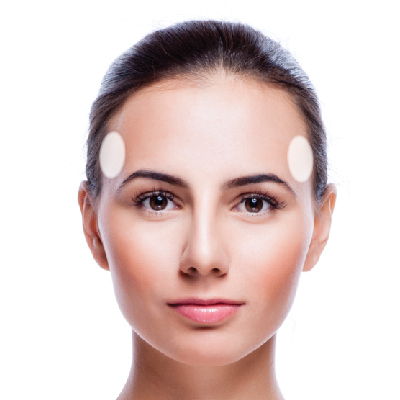 Hiện tượng huyệt thái dương lõm ảnh hưởng đến thẩm mỹ khuôn mặt
