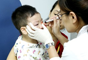 Khám trước khi phẫu thuật mắt lác