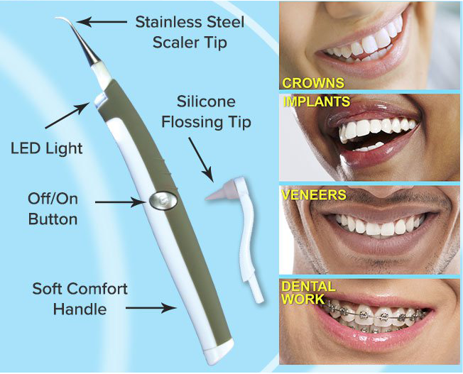 Dụng cụ lấy cao răng tại nhà