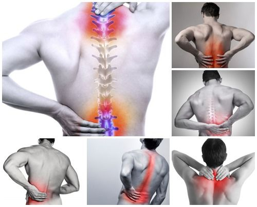 Các vị trí thường xuyên xảy ra thoái hóa cột sống