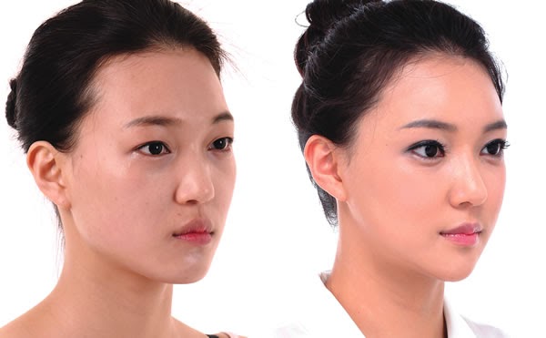 Cách làm đầy má hóp tự nhiên