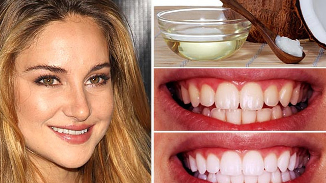 Sử dụng khăn mềm kết hợp các tinh chất để lấy cao răng