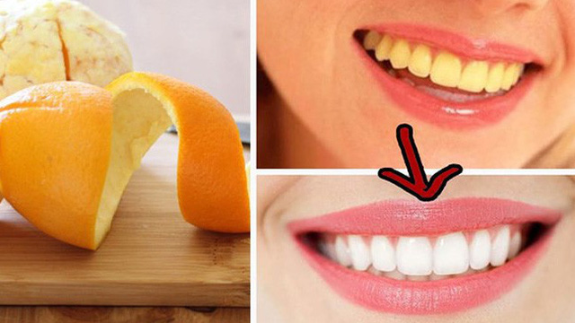 Vỏ cam là một trong những phương pháp và cách làm trắng răng bị vàng