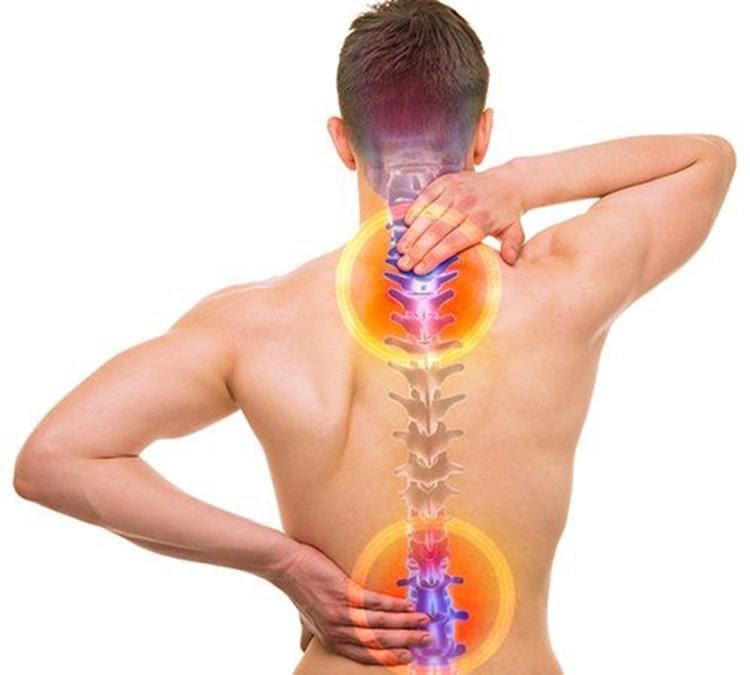 Bệnh thoái hóa cột sống