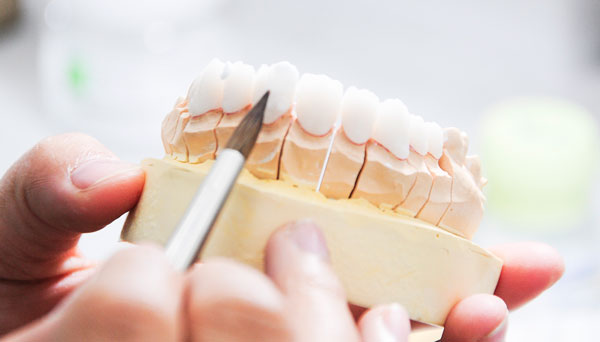 Cả 2 loại răng cercon và ceramill đều có tuổi thọ cao 