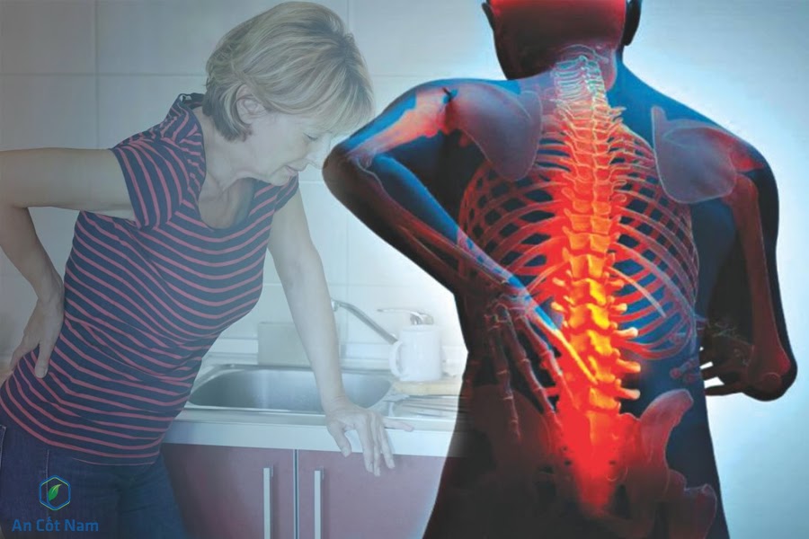 Nguyên nhân gây ra thoái hóa cột sống